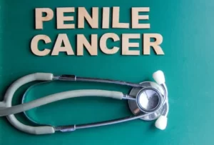 Penile Cancer Penile Tumor