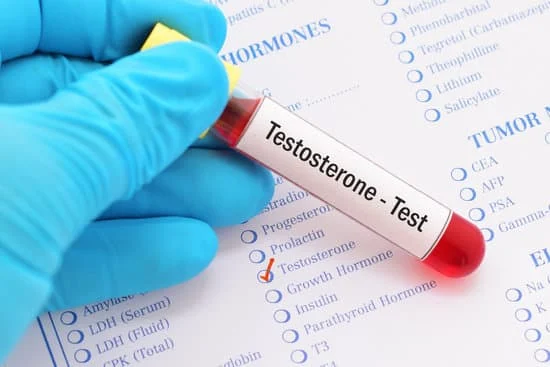 testosterone test